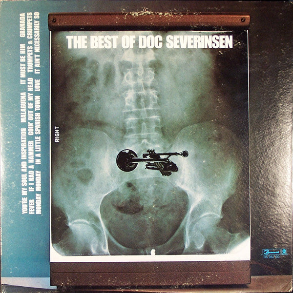 Severinsen, Doc - The Best Of Doc Severinsen (VG) (Vinyl LP)